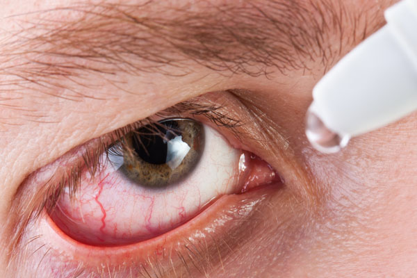 image of homeowner putting artificial tears in eyes depicting poor air quality in winter